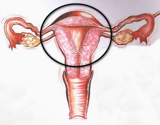 Uterus - Chirurgie Viscérale