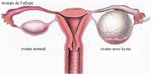Uterus - Chirurgie Viscérale